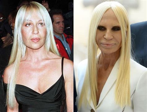 donatella versace marzo 2019|donatella versace before and after surgery.